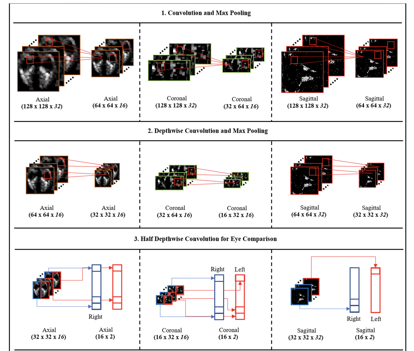 Neural Network-based Method for Diagnosing Graves' Orbitopathy Using Orbital Computed Tomography